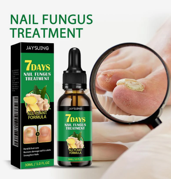 Ginger Nail Treatment Nail Support Nail Care