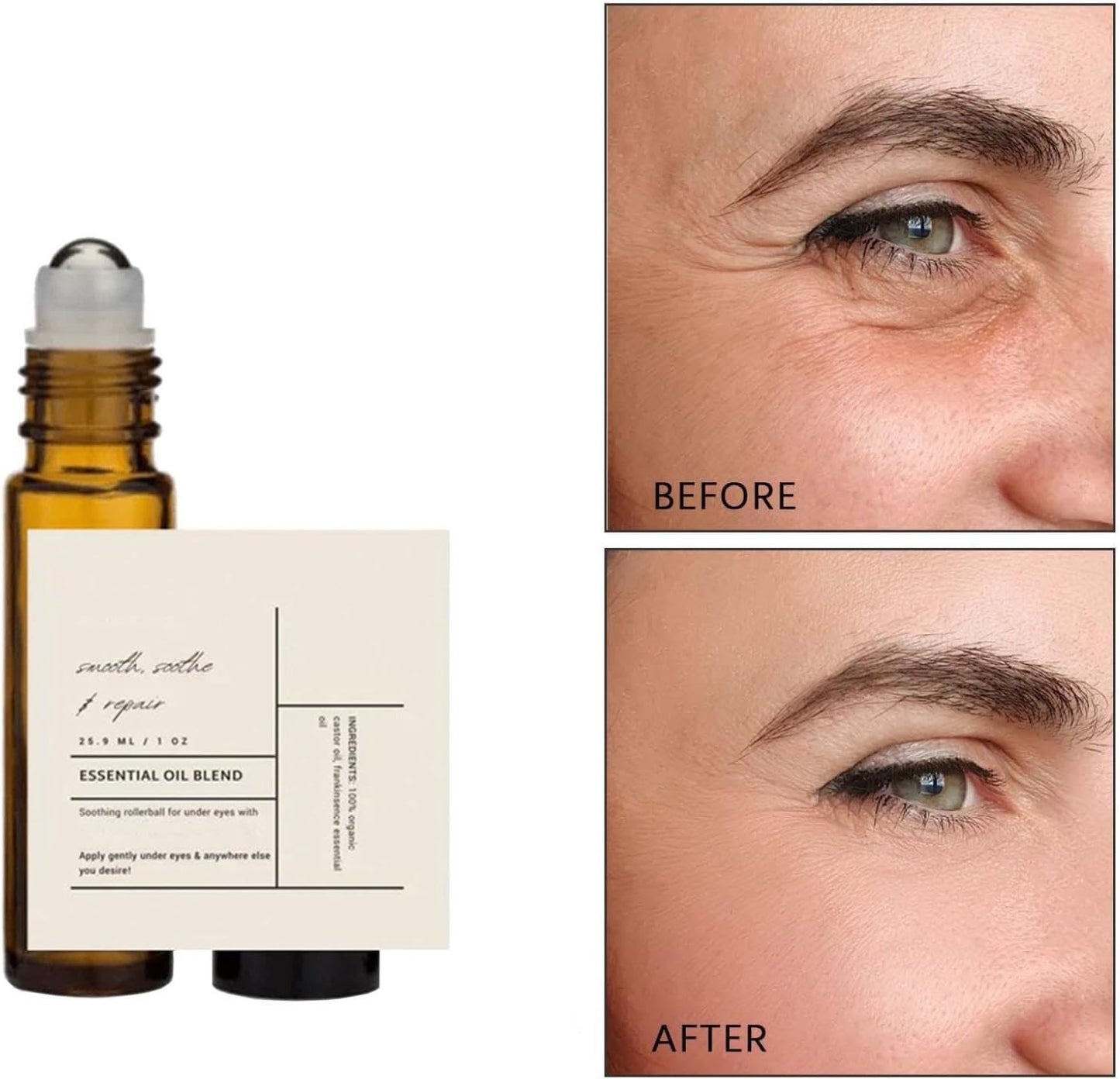 Time Eraser Roll-On Oil – Castor & Frankincense Nourishing Eye Roller