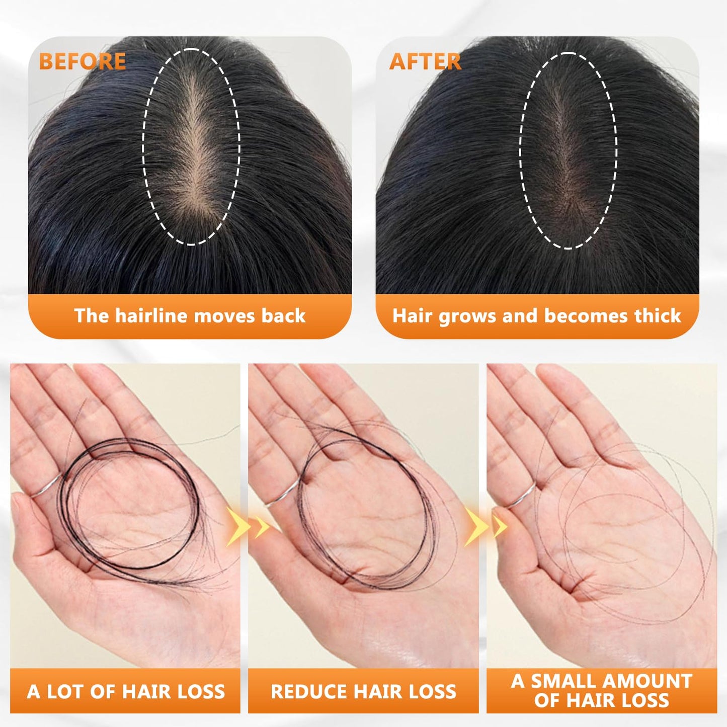 Anti-Hair Fall Hair Loss Shampoo, RemimpiAnti Hair Loss Shampoo, Anti-Hair Fall Promote H air Growth Shampo o, Routine Shampo o for Women H air L oss, for All H air Types