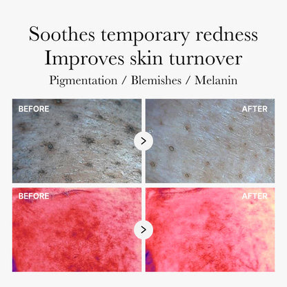 Mix & Match Toner Padㅣ Pore, Use After Spot, Brightening Care for Clear & Glass Glow SkinToner Pads